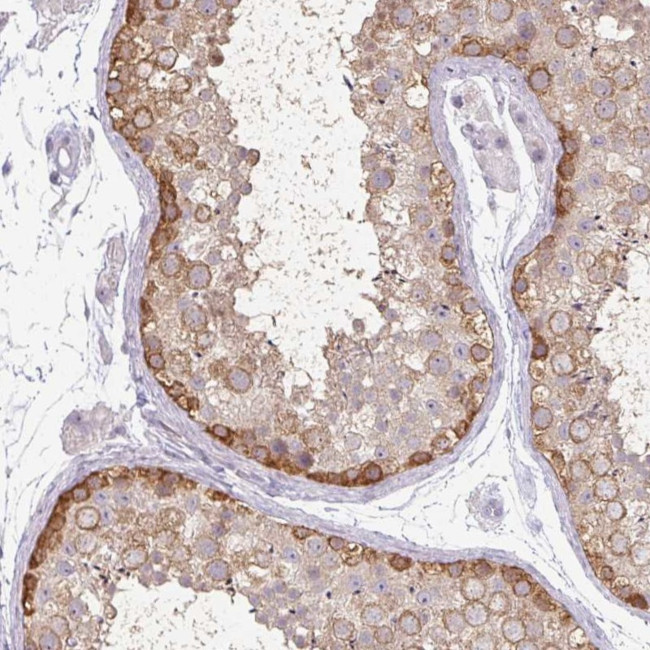 MAGEC3 Antibody in Immunohistochemistry (Paraffin) (IHC (P))