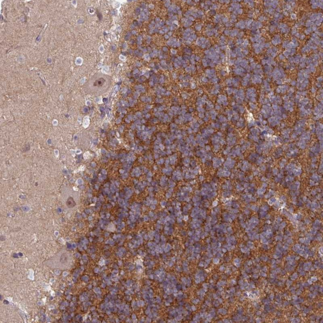 TTLL7 Antibody in Immunohistochemistry (Paraffin) (IHC (P))