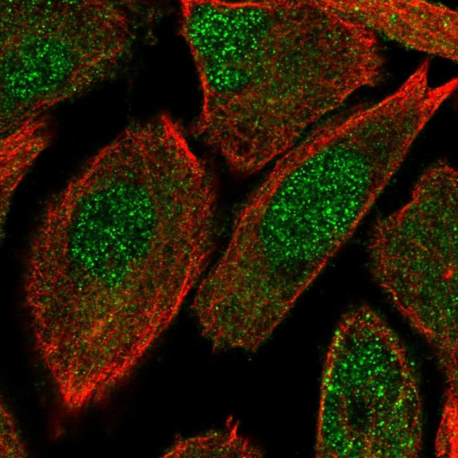 OIP5 Antibody in Immunocytochemistry (ICC/IF)