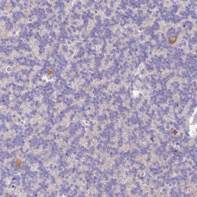 SLC38A1 Antibody in Immunohistochemistry (Paraffin) (IHC (P))