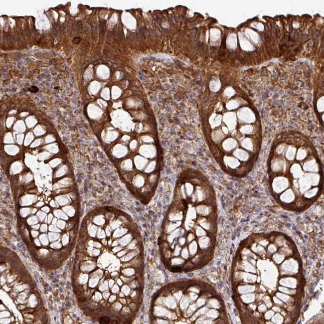 ARPIN Antibody in Immunohistochemistry (IHC)