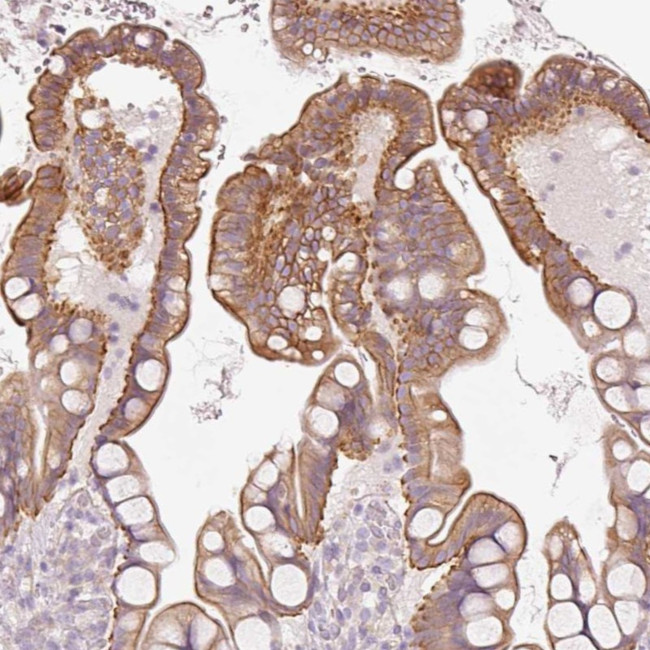 OSR2 Antibody in Immunohistochemistry (Paraffin) (IHC (P))