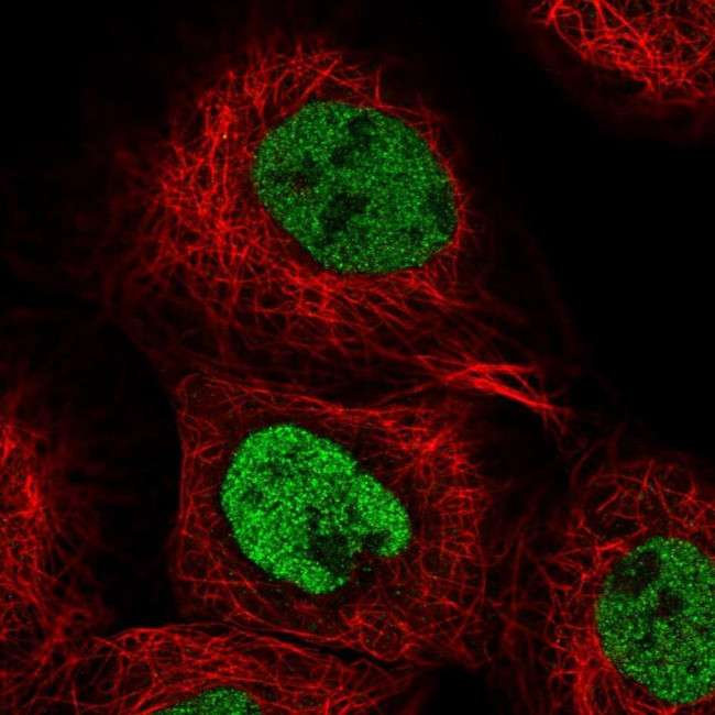 EYA3 Antibody in Immunocytochemistry (ICC/IF)