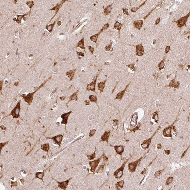 KLC1 Antibody in Immunohistochemistry (Paraffin) (IHC (P))