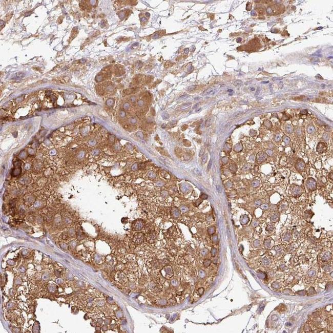 GSPT1 Antibody in Immunohistochemistry (IHC)