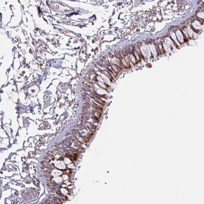 OR2D3 Antibody in Immunohistochemistry (Paraffin) (IHC (P))