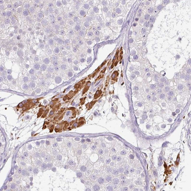 FGF17 Antibody in Immunohistochemistry (Paraffin) (IHC (P))