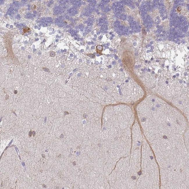 WSB2 Antibody in Immunohistochemistry (IHC)