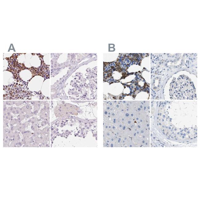 SERPINB1 Antibody in Immunohistochemistry (IHC)