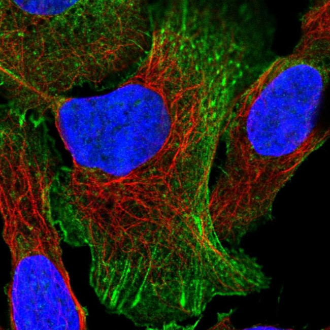 EPLIN Antibody in Immunocytochemistry (ICC/IF)