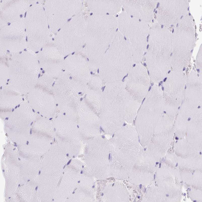 CEL Antibody in Immunohistochemistry (Paraffin) (IHC (P))