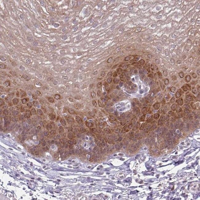 KLC3 Antibody in Immunohistochemistry (IHC)