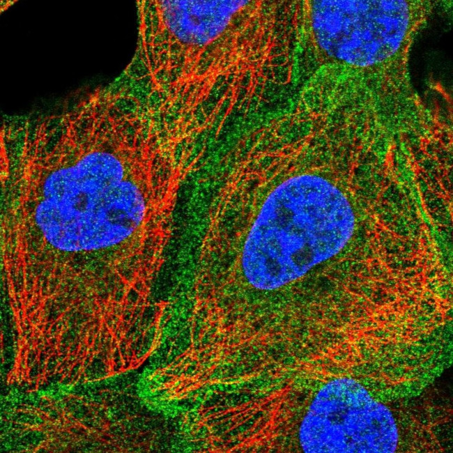 Nhe-1 Antibody in Immunocytochemistry (ICC/IF)