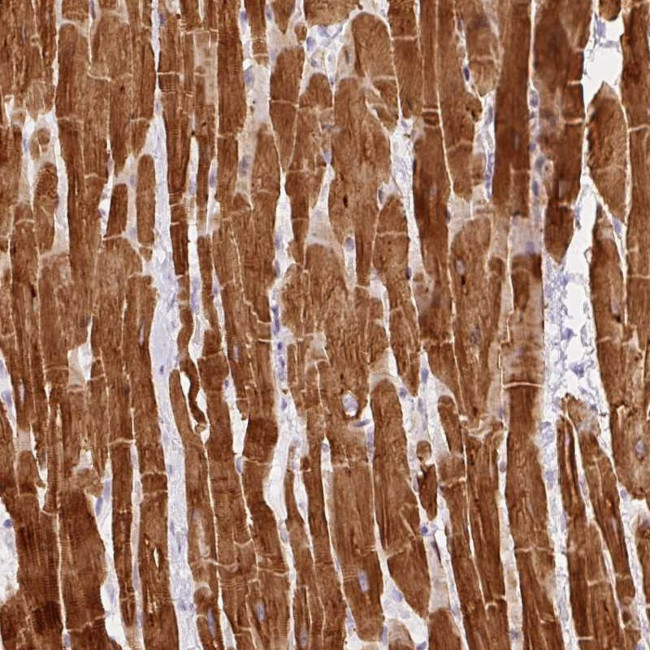 PHOSPHO1 Antibody in Immunohistochemistry (Paraffin) (IHC (P))