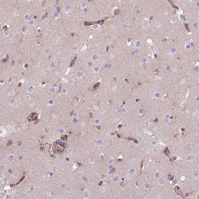 COL8A1 Antibody in Immunohistochemistry (Paraffin) (IHC (P))