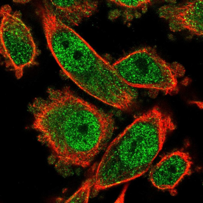 AdoHcyase 3 Antibody in Immunocytochemistry (ICC/IF)