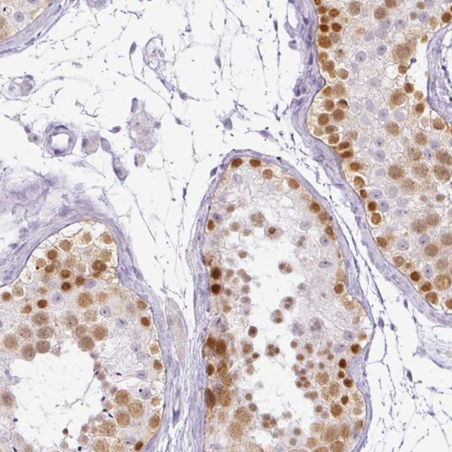 RBMY1F Antibody in Immunohistochemistry (Paraffin) (IHC (P))