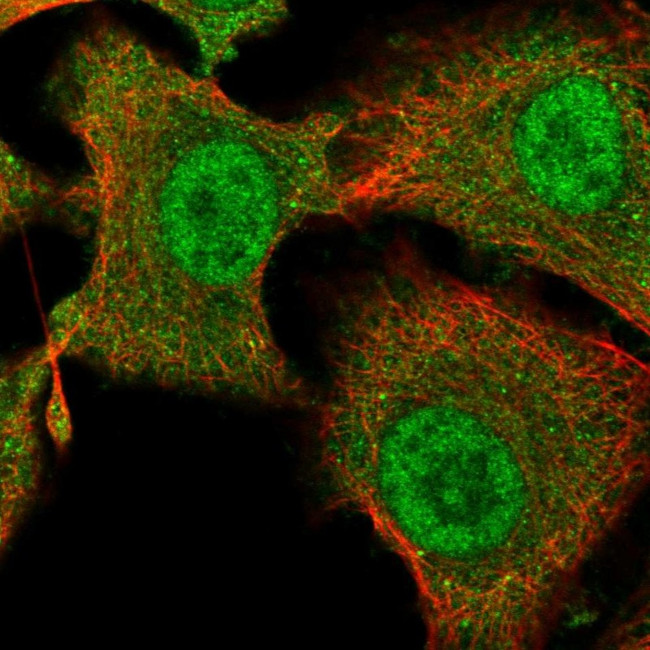 TESC Antibody in Immunocytochemistry (ICC/IF)