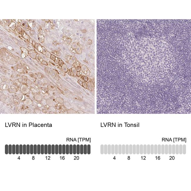 AQPEP Antibody in Immunohistochemistry (IHC)