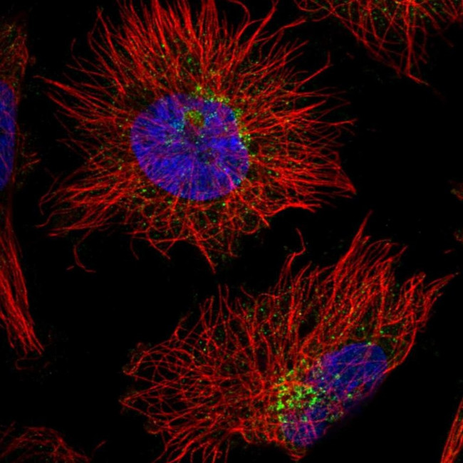 AGPAT4 Antibody in Immunocytochemistry (ICC/IF)