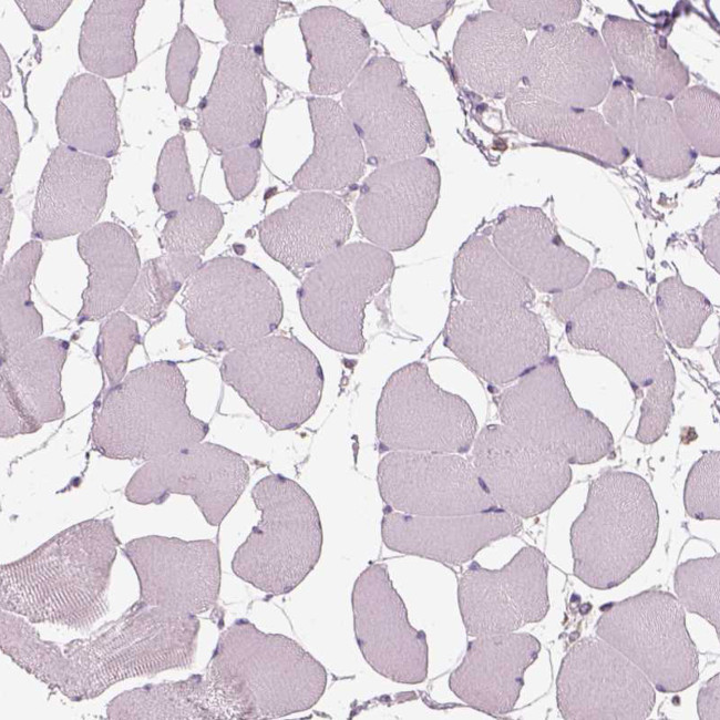 OTUD6A Antibody in Immunohistochemistry (Paraffin) (IHC (P))