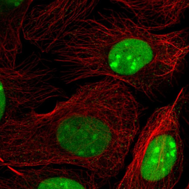 HMGB2 Antibody in Immunocytochemistry (ICC/IF)