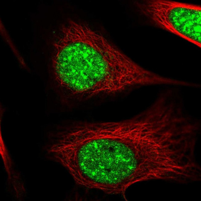 ZC3H14 Antibody in Immunocytochemistry (ICC/IF)