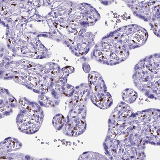 MEOX2 Antibody in Immunohistochemistry (Paraffin) (IHC (P))