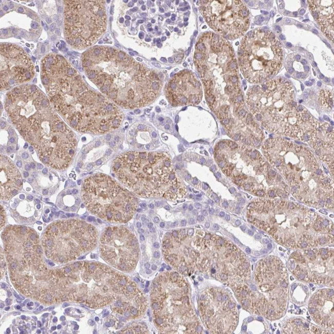 CTU1 Antibody in Immunohistochemistry (Paraffin) (IHC (P))