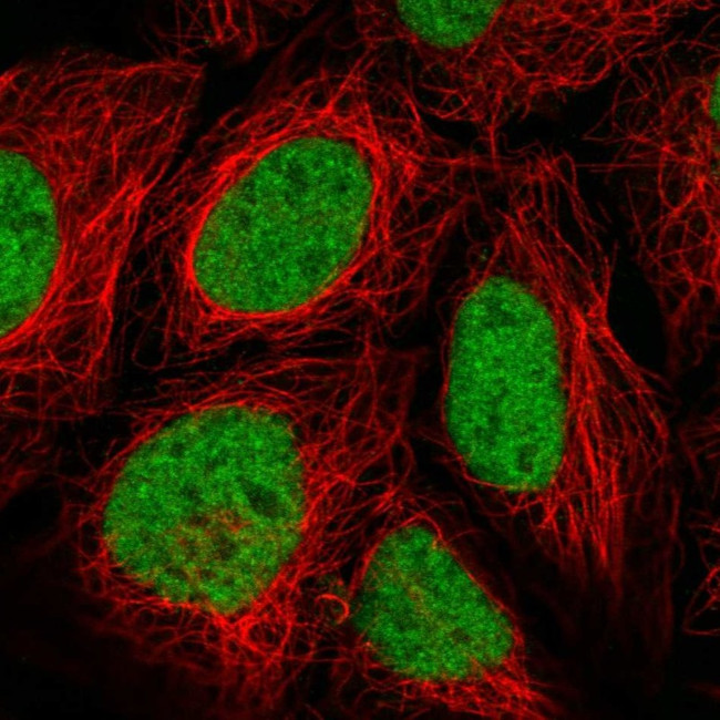 FUSIP1 Antibody in Immunocytochemistry (ICC/IF)