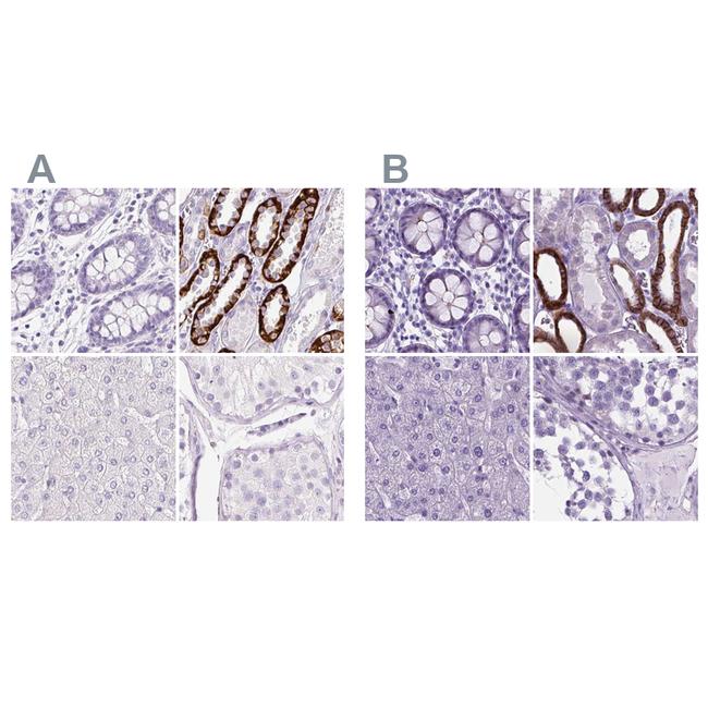 BSND Antibody in Immunohistochemistry (IHC)