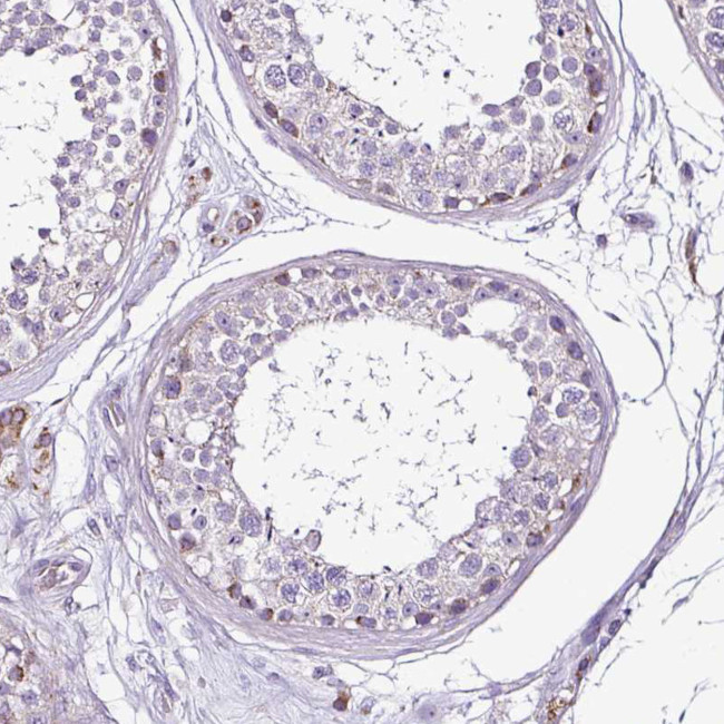 DPAGT1 Antibody in Immunohistochemistry (Paraffin) (IHC (P))