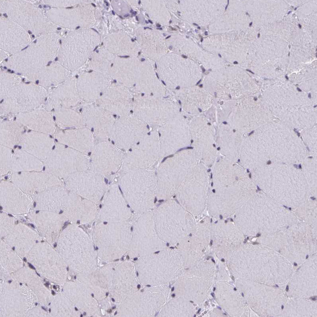 AKAP5 Antibody in Immunohistochemistry (Paraffin) (IHC (P))