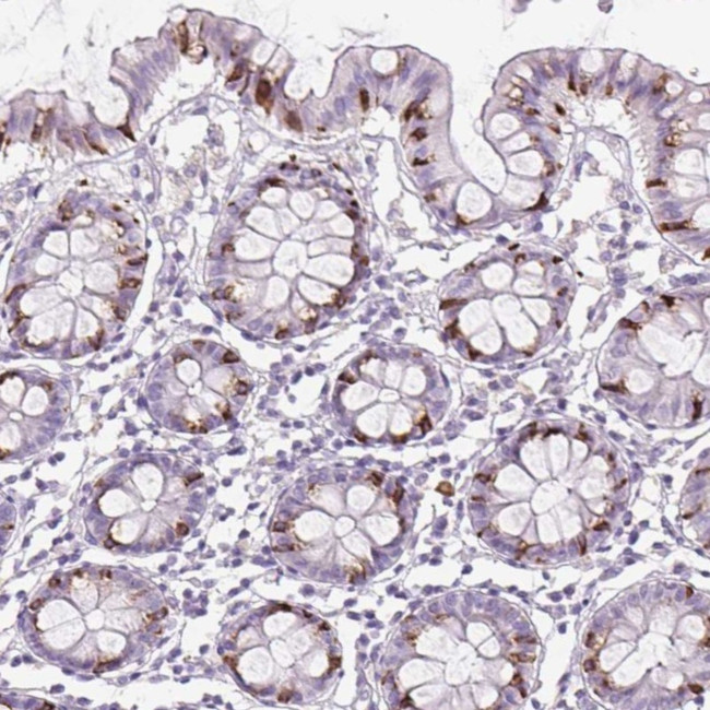 FGFBP3 Antibody in Immunohistochemistry (Paraffin) (IHC (P))