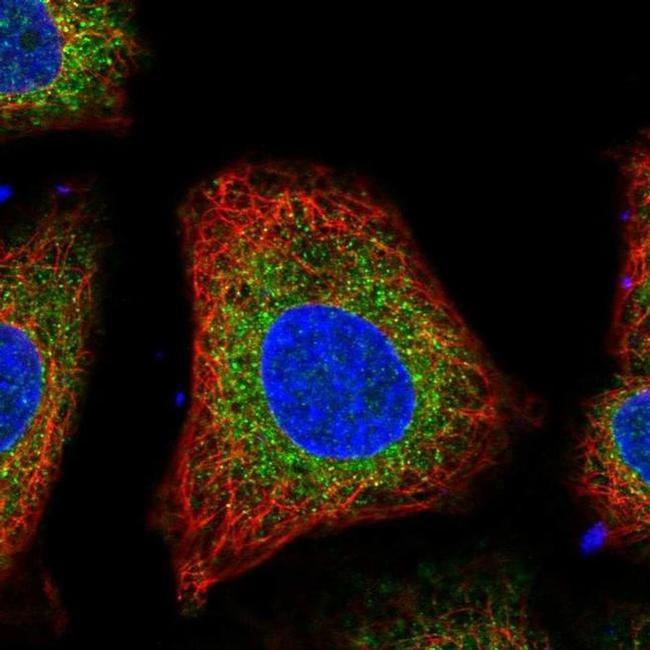 VKORC1L1 Antibody in Immunocytochemistry (ICC/IF)