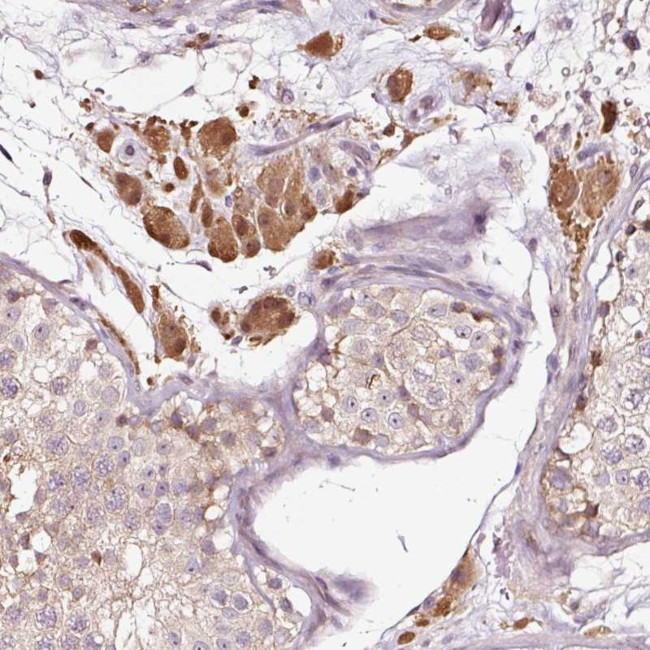 UTP14C Antibody in Immunohistochemistry (Paraffin) (IHC (P))