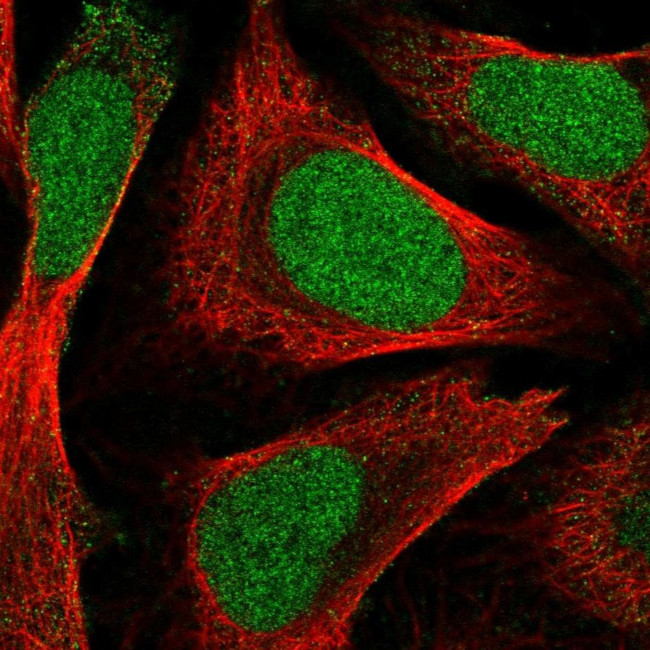 ZNF580 Antibody in Immunocytochemistry (ICC/IF)