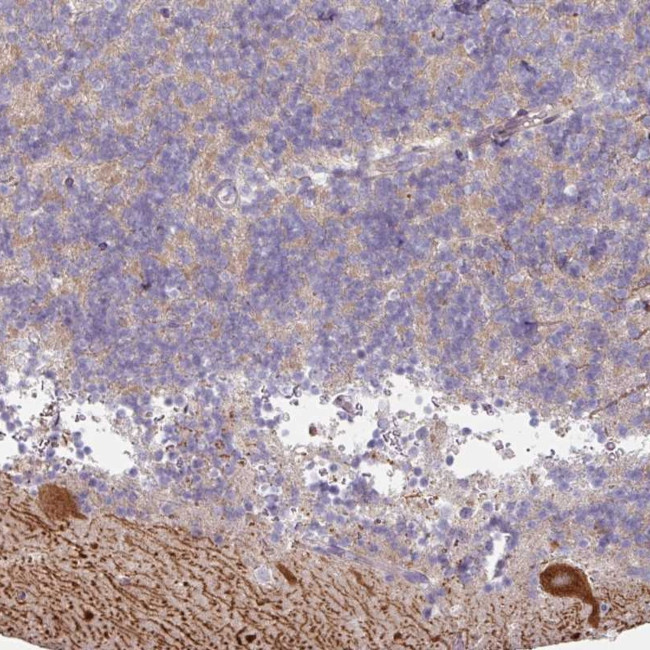 MTMR14 Antibody in Immunohistochemistry (Paraffin) (IHC (P))