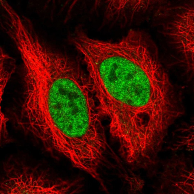 NEIL1 Antibody in Immunocytochemistry (ICC/IF)