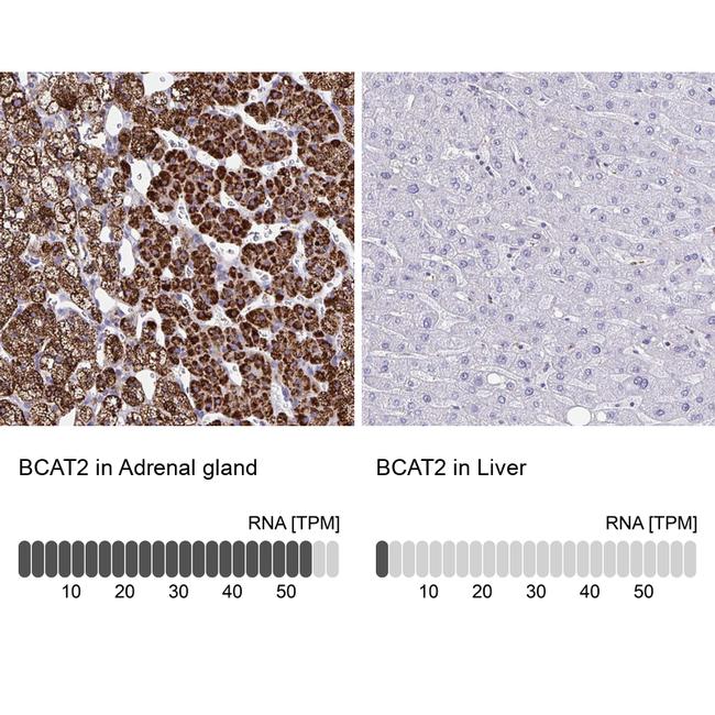 BCAT2 Antibody in Immunohistochemistry (IHC)