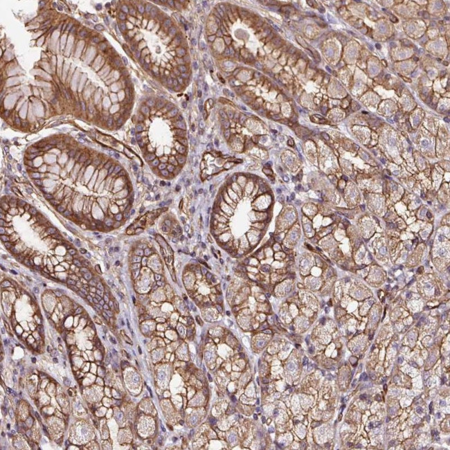 B3GALT5 Antibody in Immunohistochemistry (Paraffin) (IHC (P))