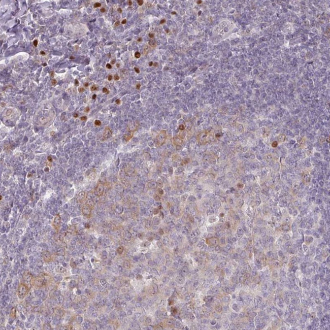 ZBTB6 Antibody in Immunohistochemistry (Paraffin) (IHC (P))