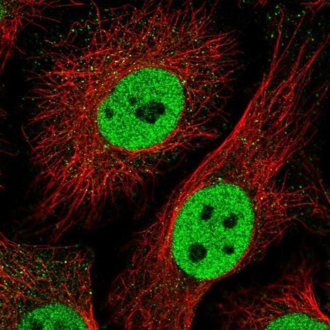 TLE3 Antibody in Immunocytochemistry (ICC/IF)