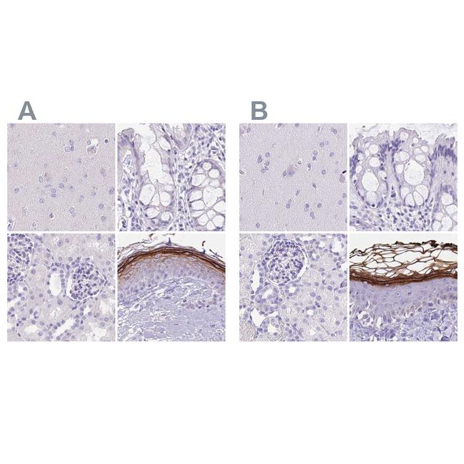 CDSN Antibody in Immunohistochemistry (IHC)