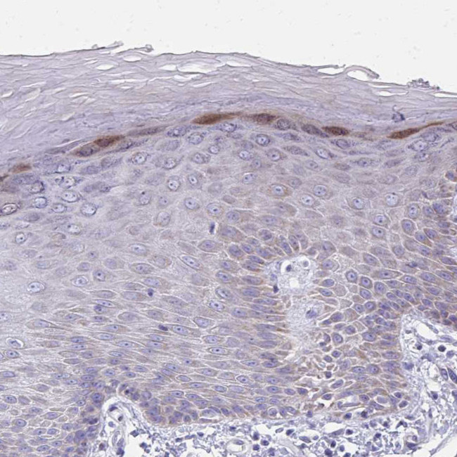 IL-37 Antibody in Immunohistochemistry (Paraffin) (IHC (P))