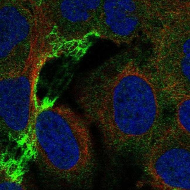 CHRNA5 Antibody in Immunocytochemistry (ICC/IF)