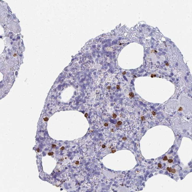 Rubicon Antibody in Immunohistochemistry (Paraffin) (IHC (P))