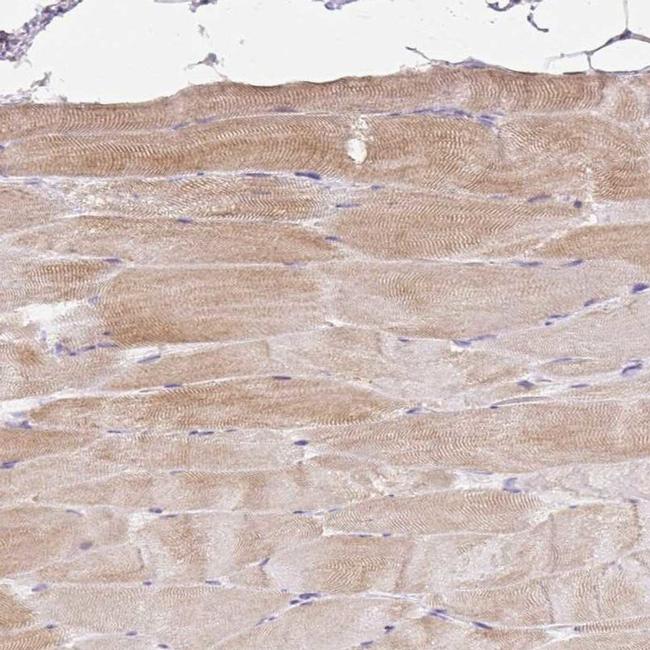 Bestrophin 3 Antibody in Immunohistochemistry (IHC)