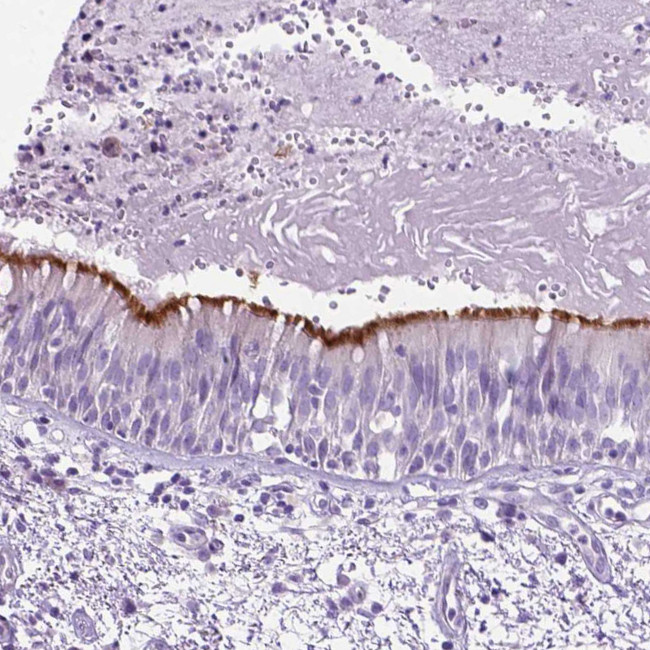 CCDC151 Antibody in Immunohistochemistry (Paraffin) (IHC (P))