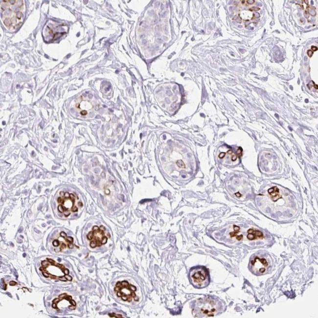 IRX2 Antibody in Immunohistochemistry (IHC)